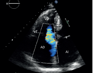 Minimanual Edocardioscopia para médicos de atención primaria