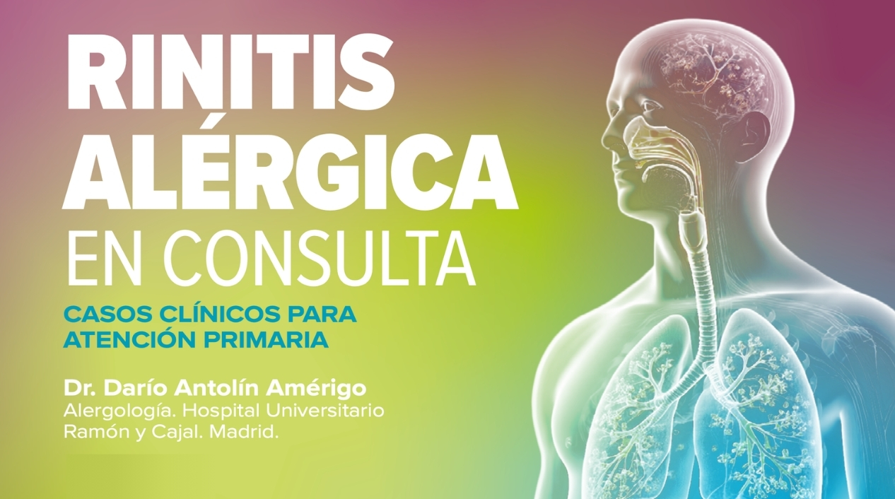 Rinitis alérgica en consulta. Casos clínicos para Atención primaria